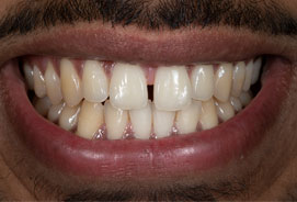 Before